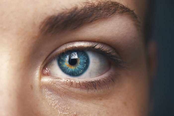 How to Get Rid of Stubborn Bags under Your Eyes